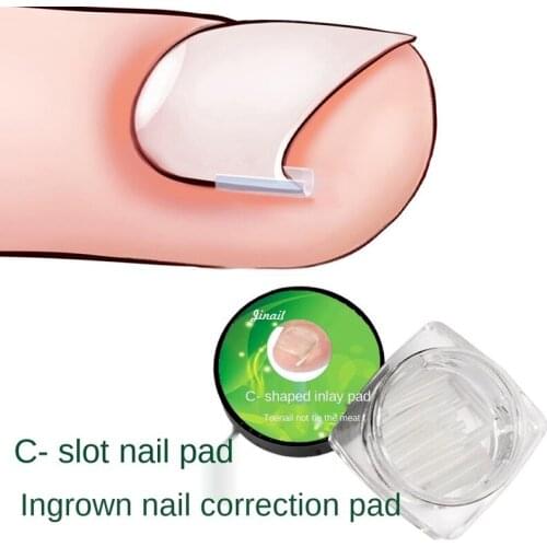 10pcs/set Ingrown Nail Pad Ortho Nail Filling Nail Groove Pad Ingrown Nail Corrector Ingrown Nail Artifact