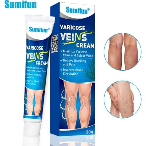 Sumifun Varicose Veins Treatment Cream Phlebitis Varicosity Angiitis Plaster Spider Leg Ointment For Relief Leg Pain Numbness