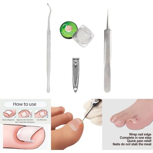 Professional Ingrown Toenail Lifter Correction Tools Toe Nail File Clippers Nail Cleaner Manicure Pedicure Podiatry Tool