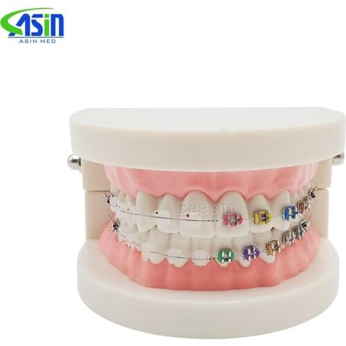 New Orthodontics Model for Dentist Dental 1/2 Standard Dentition with half Metal Brackets half ceramic bracket Teeth Model