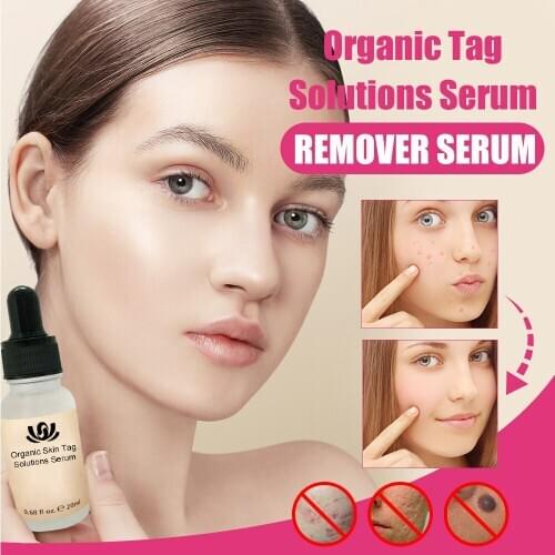 Organic Tags Solutions Serum Herbal Treatment Serum Remove Unwanted Flaws 20ML Mole remover for face Personal Skin Care