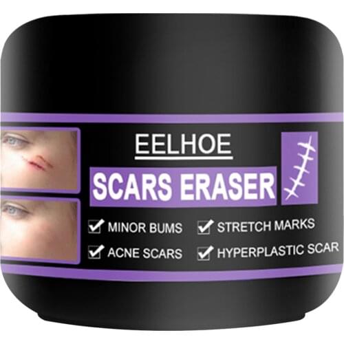 Acne Scar Removal Gel Skin Stretch Marks Repair Anti Spots Acne Treatment Blackhead Whitening Cream Shrink Pores Skin Care
