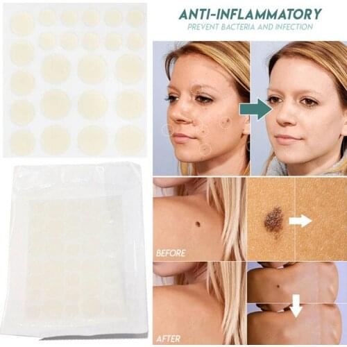 Women Body Anti-infection Face Care Ance Pimple Patch Skin Tag Remover Patch Hydrocolloid Master Plaster Acne