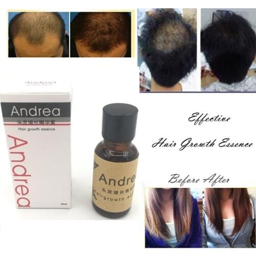 10pcs Andrea Hair Growth Ginger Oil Natural Plant Essence Faster Grow Beard Eyelashes Hair Tonic Shampoo Hair Loss Hair Care set