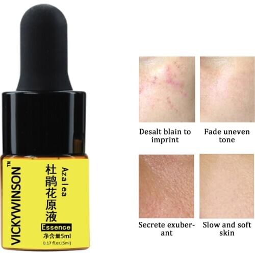 Azalea essence 5ml Serum for Face CreamAnti Wrinkle Aging Hyaluronic Essence Whitening Cream Face Serum