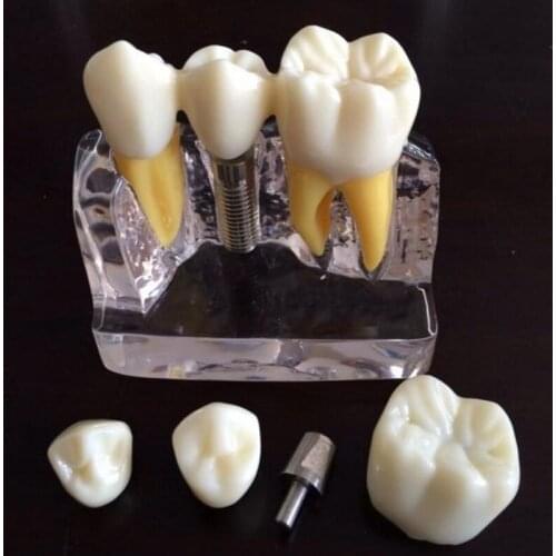 AIBODUO Sets For Teeth