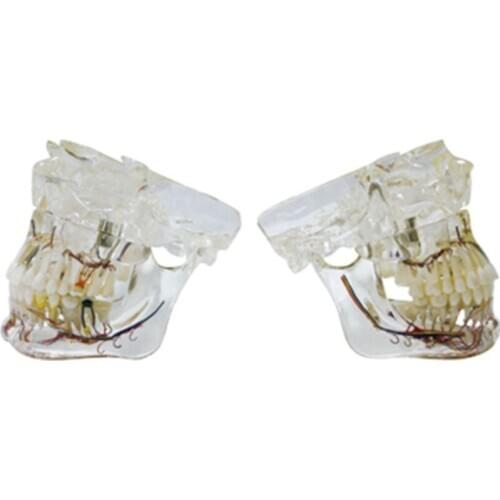 Transparent Dental pathological model with nerve