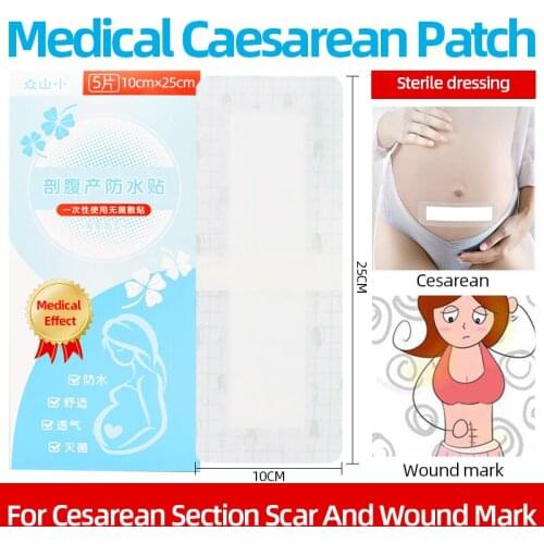 10cm*25cmMedical caesarean section Wound Dressing Medical Sterile Adhesive Wound Dressing large Size Band-aid Economic type
