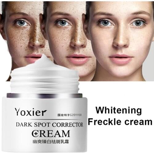 Dark Spot Corrector Face Body Cream Fade Dark Spots Freckles Brighten Skin for Face Arms Legs for Men Women