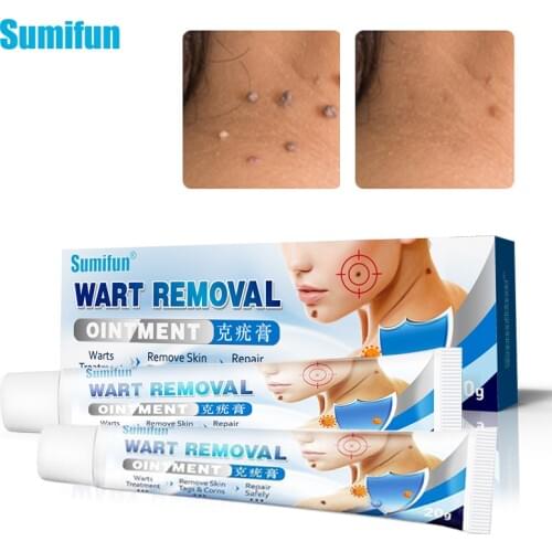 3pcs Sumifun Skin Tag Cream Warts Remover Antibacterial Ointment Plaster Genital Warts Plantar Warts Ointment Herbal Extract