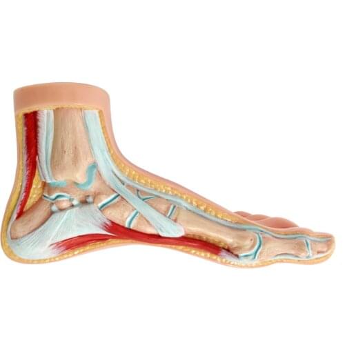 Human Foot Model Foot Muscles Flatfoot Talipes cavus Bow foot model Anatomical Anatomy Medical Science teaching model