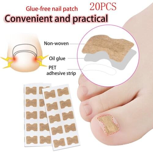 20 Sticker Finger Toe Incorporated Orthodontic Toe Thumb Patch Roll Fast Toe Pedicure Nail Files treatment Sticker Pedicure Tool