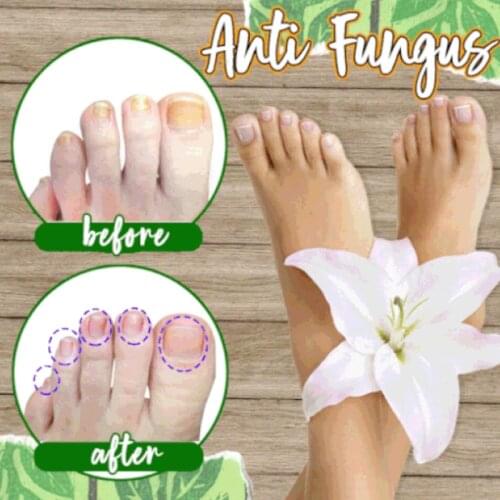 2021New Fungal Nail Detox Foot Soak Long-Term Relief Athletes Foot Skin Cracking Psoriasis Peeling Foot Bath Care TSLM1