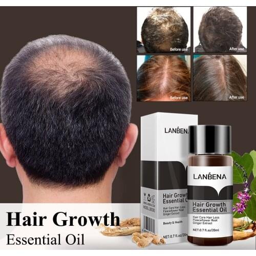LANBENA Powerful Promote Hair Growth Essential Oil Hair Loss Product Treatment Preventing Bald Scalp Hair Care for Women Men