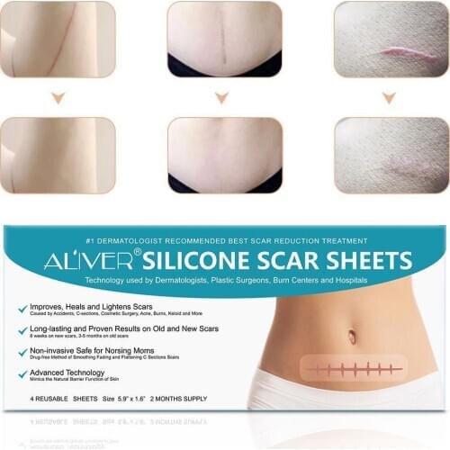 Silicone Surgical Scar Removal Patch Remove Trauma Treatment Scar Skin Scar Removal Patch For Acne Burn Repair Sheet Therap G1W0