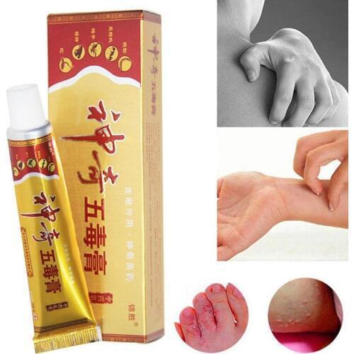 1PC Skin Herbal Psoriasis Pruritus Cream Dermatitis Eczematoid Eczema Ointment Treatment Psoriasis Cream Skin Care Cream