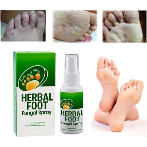 30ml Feet Spray Remover Herbal Odor Sweat Antibacterial Deodorant Bacteriostatic Plant Herb Spray Foot Treatment Spray Liquid