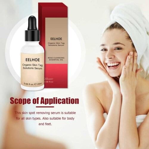 20ml Wart Herbal Antibacterial Liquid Warts Remover Cream Skin Tag Removal Against Mole Eliminator Skin Purifying Essence