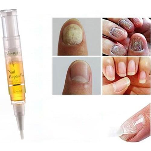 Nail Repair Pen,Onychomycosis Nail Care Solution-Repair Toenails and Fingernails