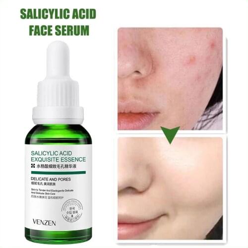 Aloe Salicylic Acid Acne Treatment Serum Oil Control Shrink Pores Face Essence Hyaluronic Acid Moisturizing Brighten Skin Toner