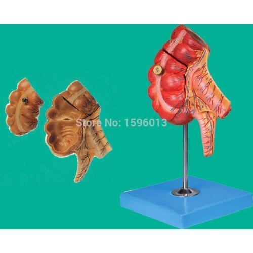 Appendix and Caecum Model, caecum and appendix model