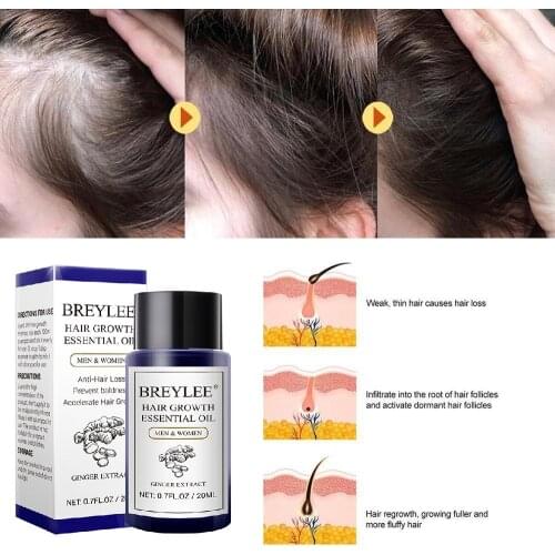 BREYLEE Hair Growth Essential Oil Hair Loss Liquid Hair Growth Serum Prevent Baldness Anti-Hair Increase Hair Hair Loss Products