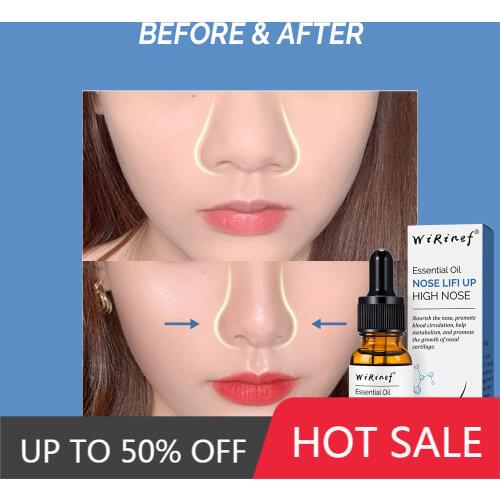 Nose Essential Oil Up Heighten Rhinoplasty Collagen Firming Moisturizing skin Nose Serum Reshape Natural Face Skin Care