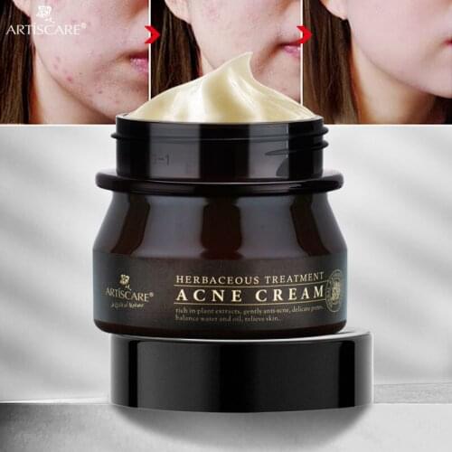 Effective anti acne cream acne treatment fade spot scar oil control shrink pores whitening and moisturizing acne cream skin care