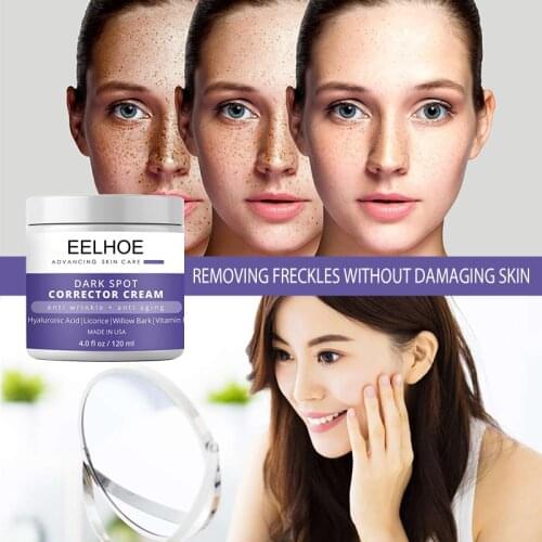EELHOE Anti Wrinkle Freckle Cream Remove Melasma Acne Spot Melanin Dark Spots Pigmentation Moisturizing Gel Skin Care TSLM2
