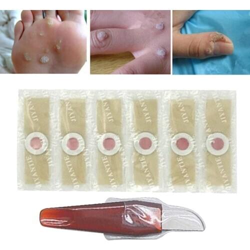 Foot Corn Removal with Hole Corn Remover Pads Wart Stickers Adhesive with