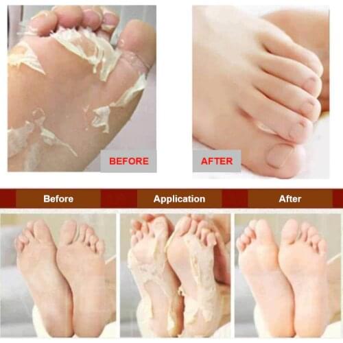 GreatMasterHome Skin Care Devices