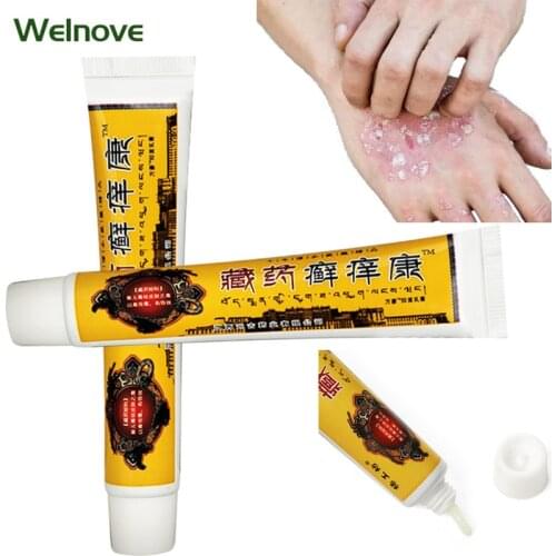 20g Psoriasis Anti itch Ointment Antibacterial Cream Eczema Dermatitis Treatment Relief Skin Itching Care Herbal Ointment