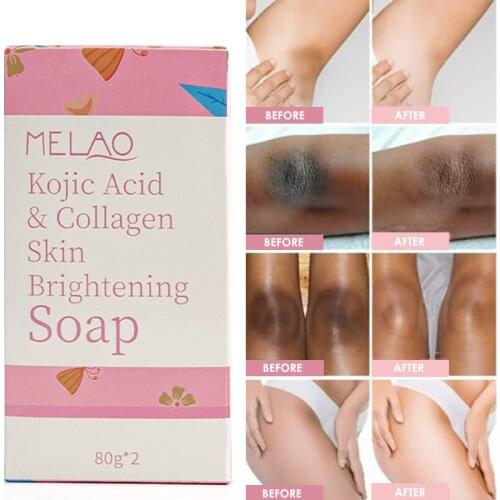 Dark Black Skin Lightening Soap Kojic Acid Whitening Soap Kojic Acid Glycerin Brighten Face Body Skin Bleaching Soap 80g