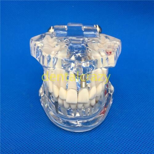 High Quality Dental Teeth Models Are Used For Teaching And Hospital Dentist Material