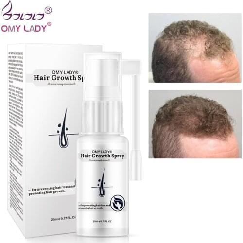 OMY LADY Anti Hair Loss Hair Growth Spray Essential Oil Liquid For Men Women Dry Hair Regeneration Repair Hair Loss Product 20ML