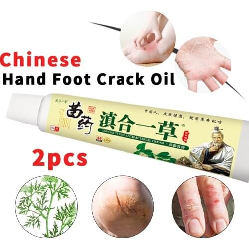 Dermatitis Eczematoid Eczema Ointment Treatment Psoriasis Cream Skin Care Cream Anti-Drying Chapped Nourish Moisturize Skin Care