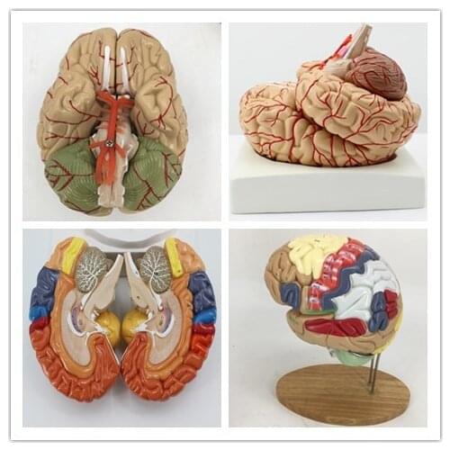 Detachable Human brain anatomy model cerebrovascular brain model medical teaching equipment