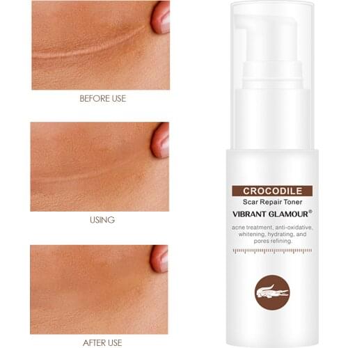 VIBRANT GLAMOUR Crocodile Face Toner Repair Scar Serum Removal Acne Shrink Pores Brighten Relieve Sensitive Skin Care 30g