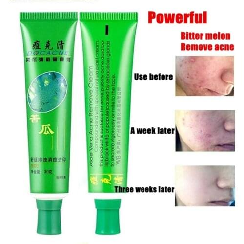 30g Face Cream Beauty Product Face Skin Repairing Acne Cream Oil Control Acne Remover Facial Skin Care SANA889