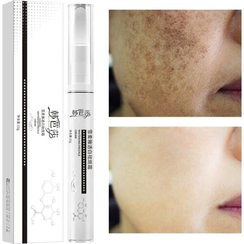 1Pcs Freckle Cream Whitening Moisturizing Remove Spot Chloasma Inhibit Melanin Brighten Repair Sodium Hyaluronate Face Skin Care