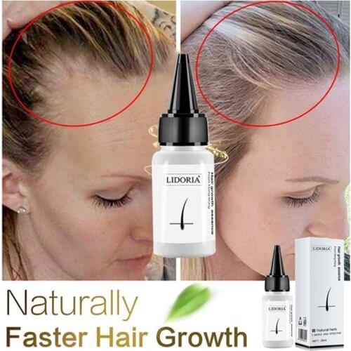 20ml Fast Hair Growth Serum Anti Preventing Hair Lose Liquid Damaged Hair Repair Treatment Eyelash Eyebrow Growing Thick Care