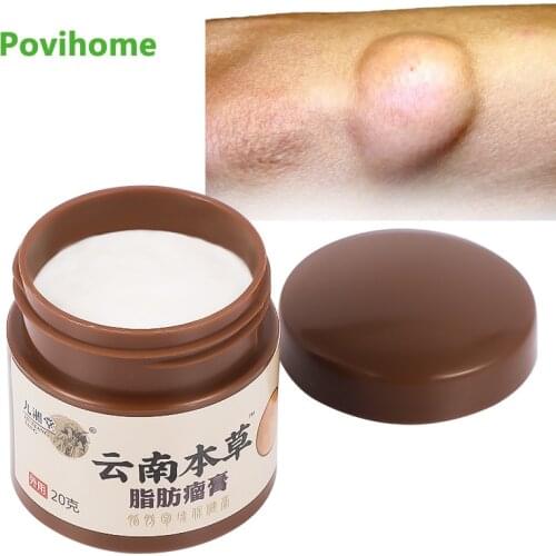 20g Herbal Lipoma Pain Relief Ointment Multiple Anti-Tumor Peeling Fat Mass Remove Cream Medicine Lipoma Removal Plaster