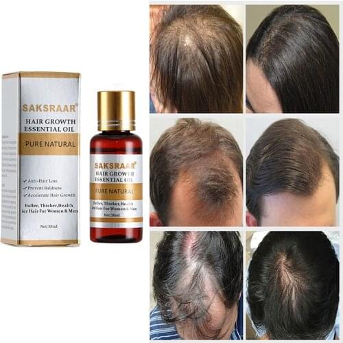 Effective Hair Growth Serum Fast Thick for Hair Prevent Hair Loss Damaged Hair Repair Natural Hair Care Products