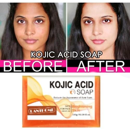 100g Kojic Acid Soap Dark Black Skin Lightening Soap Hand made Soap Glutathione Whitening Soap Skin Bleaching Soap Brighten Face