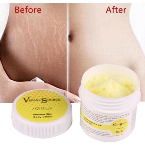 Крема от растяжек Pudaier China At AliExpress