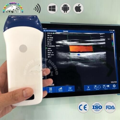 Portable Wireless Probe Scanner Color Doppler Linear Probe WIFI Connect with Android/IOS Windows System Equipment
