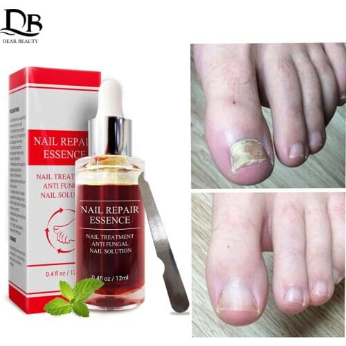 Body Slimming Belt Electric Abdominal Trainer Muscle Stimulator Toner Weight Loss New Smart EMS Fitness Vibration Belt Unisex