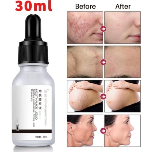 30ml Natural 5% Niacinamide Pore Treatment Serum Skin Anti-Wrinkle Repair Face Care Hydrating Brighten Skin Pore Repair Essence