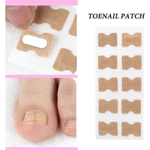 Ingrown Toenail Corrector Sticker Paronychia Treatment Fixer Recover Corrector Pedicure Foot Toe Nail Care Tool Glue Free