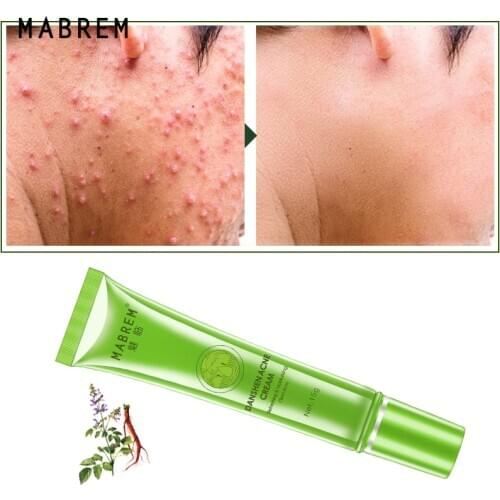 Acne Treatment Plant Face Cream Remove Acne Scar Oil Control Shrink Pores Acne Cream Nourish Whitening Moisturizing Skin 15g